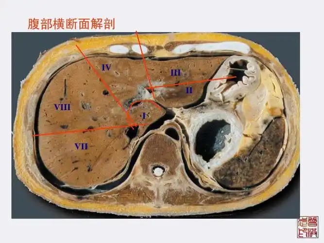 肝分段-腹部横断面解剖与影像段对照