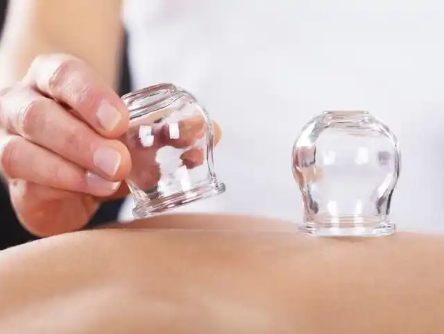 拔火罐时后背吸出来的瘀血是毒素吗或许看完就懂了