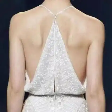 因为失去牵拉力而翘起来,背后就像长出一对小翅膀,因此命名翼状肩胛