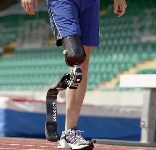 装配竞技型大腿假肢是什么感觉视频