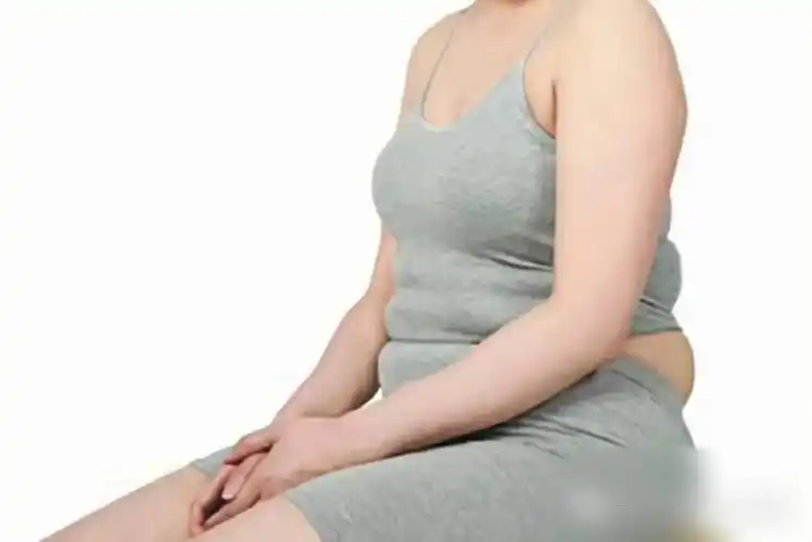 产后腹部肥胖走样当心是腹直肌分离