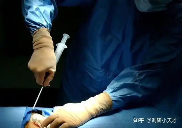 6.输精管结扎(男性结扎)