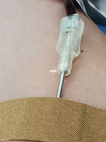 冲过去填表抽血,扎的时候我正和我朋友讲话,一转过头,wc这么大个针头