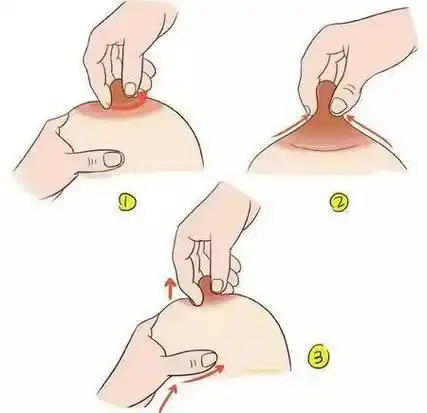 每次清洗时,注意轻轻将堵塞在乳头开口的硬颗粒清洗掉.