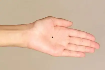 男人右手掌心有痣代表什么