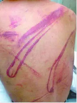 济南15岁学生遭22名同学围殴因提醒上课不该睡觉