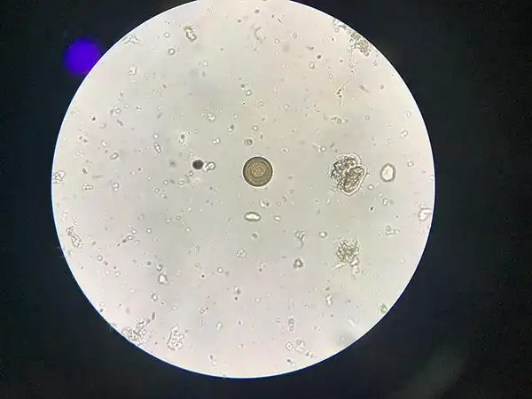 饭点慎点!上海一病人体内"养"出七八米长绦虫 生食慎食_新民社会_新民