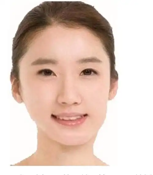 面部不对称到底是不是天生的?面部不对称检测法?