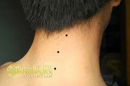 脖子后面有3颗痣代表着什么
