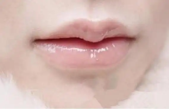 有唇珠面相桃花运好不乏追求者