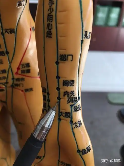 拔罐调理胃脘痛