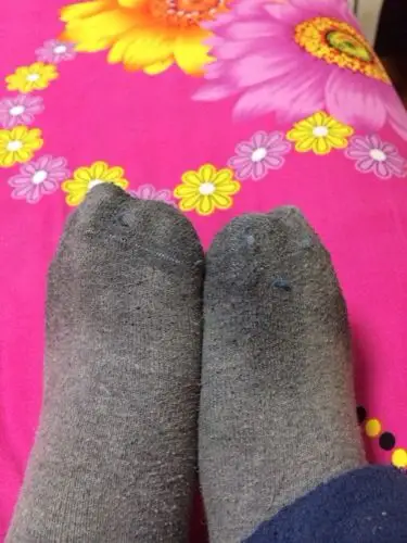 出脚汗是怎么回事,怎么治疗?