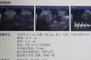 的,医生也没有权利告知,就是这个时候银行可以看一下拿到手里的孕检单