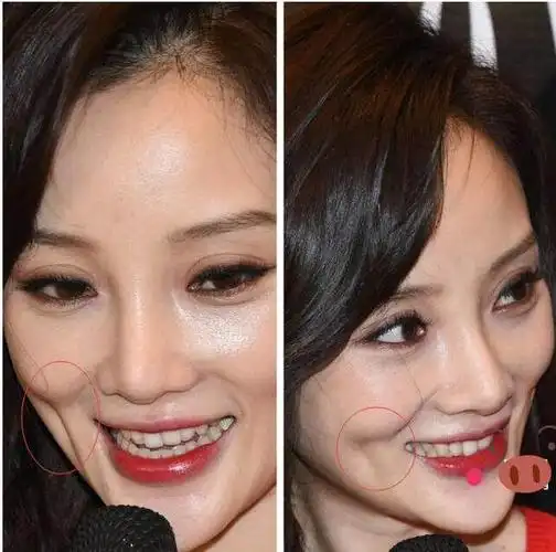 酒窝位置能决定人的命运?李小璐背负一生骂名,而唐嫣春风得意