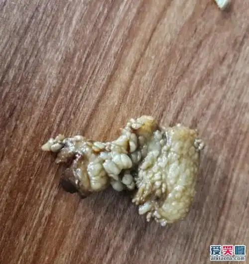 淋巴肉百度百科 淋巴肉怎么辨别 淋巴肉吃了会怎么样_多特软件资讯