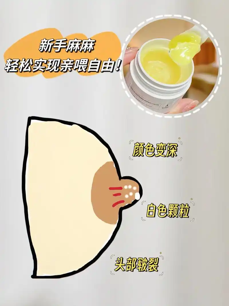 亲爱的准妈妈们~怀孕后如果出现乳头有颗粒或结痂的情况,千万不 - 抖
