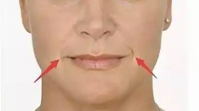 木偶纹是什么?这个让人显老的皱纹,看看你中招了吗? | 说明书网