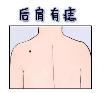 这三个部位有痣,一生财运都不差,多贵人_生活