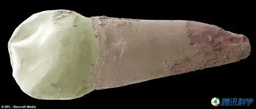 【转载】显微镜下的牙菌斑细菌?