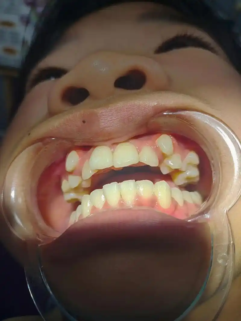 牙齿参差不齐的女生 - 抖音