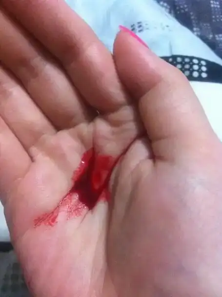 每天都流血习惯了.原来的我很帅气的,现在的我换了一张脸.自从 - 抖音