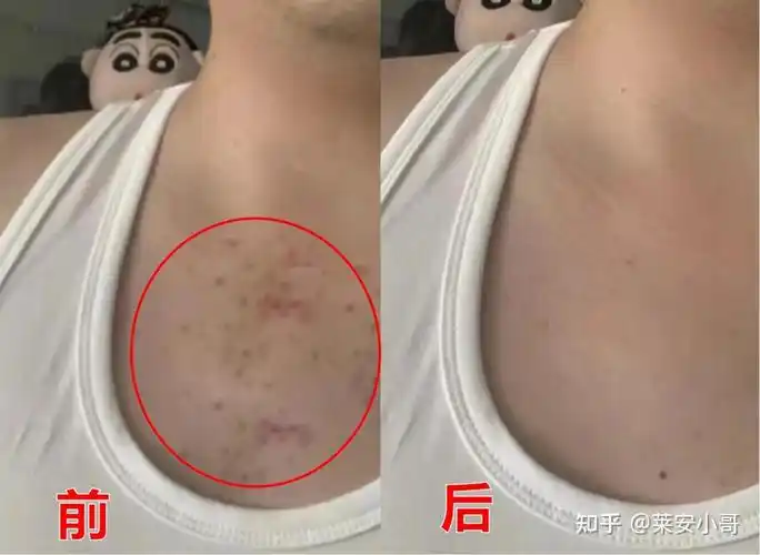 【2023秋冬男士沐浴露榜单推荐】选对这几款男士沐浴露,爆痘,出油