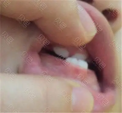 宝宝一岁地包天照片