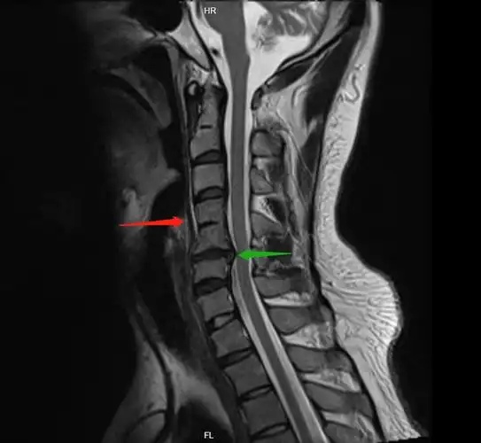重阳医院磁共振检查应用