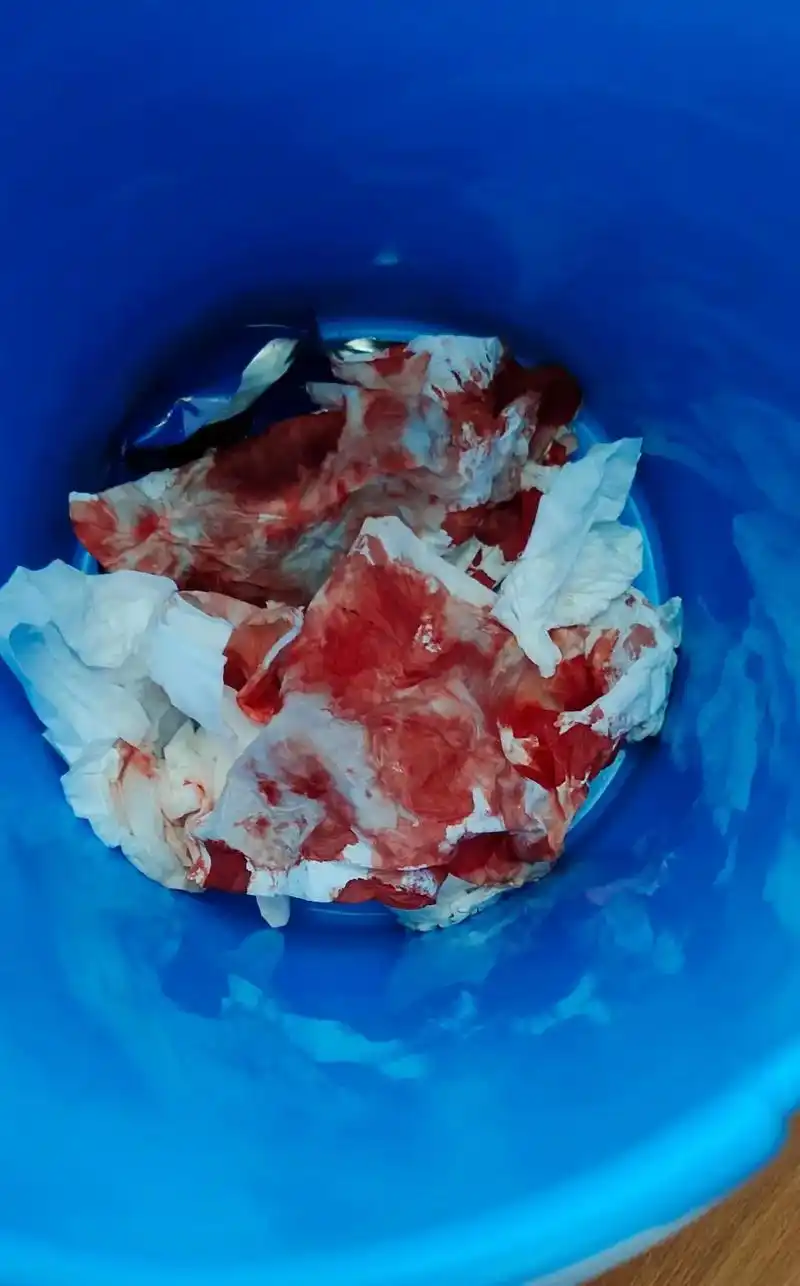 可能是因为这几天我通宵的原因,今天早上一起来就不