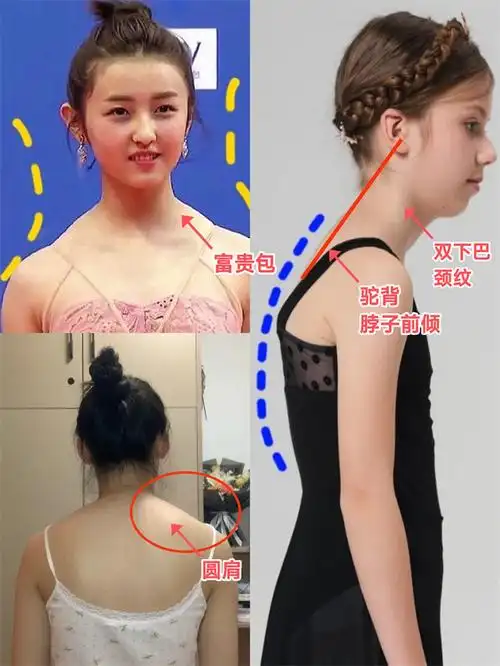 体态对女人来说有多重要,看完这些对比照后,才明白颜值不值一提插图8