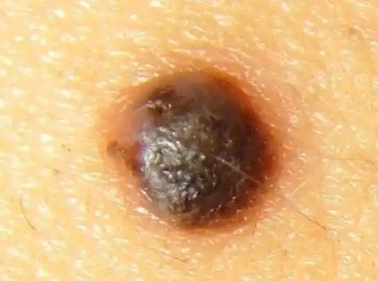 孩子身上这几个地方的"痣",或是"好福气"的寓意,你家有没有_部位_吉祥