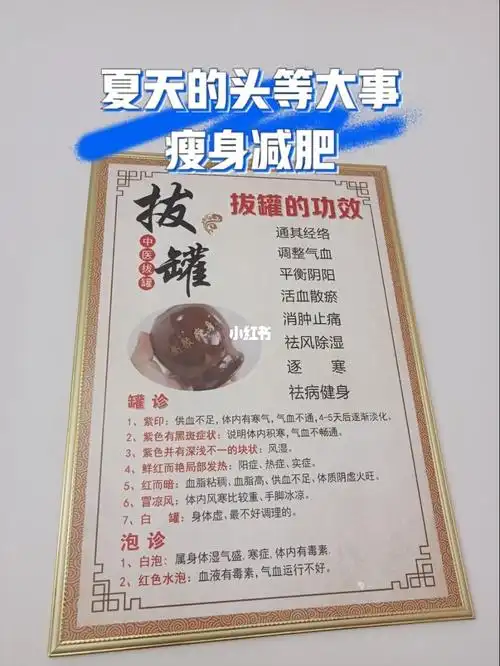 夏天瘦身季拔罐减肥