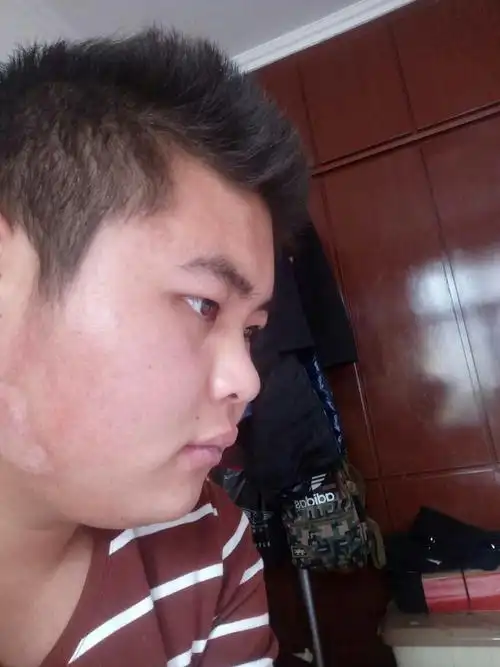 自己的鼻梁骨到底矮不矮