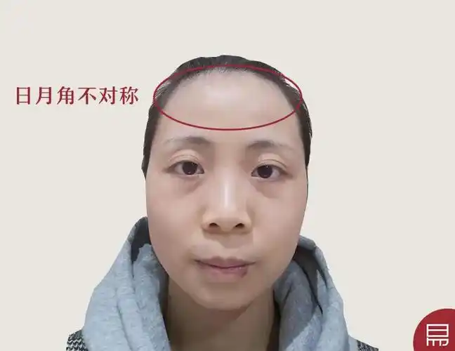 日月角不对称脸型三庭长短均衡,额头高而隆,耳朵位置比较上,说明思想