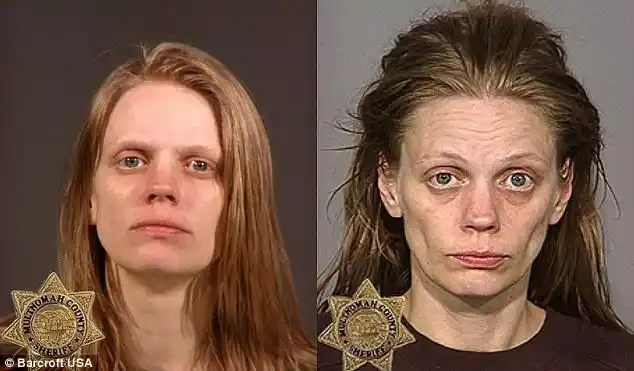 让人震惊的吸毒者前后对比照片声明:本组转载于英国《每日邮报》,照片