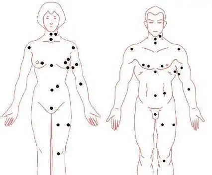 1.光荣吉痣,长在大腿根儿臀部以下的位置.