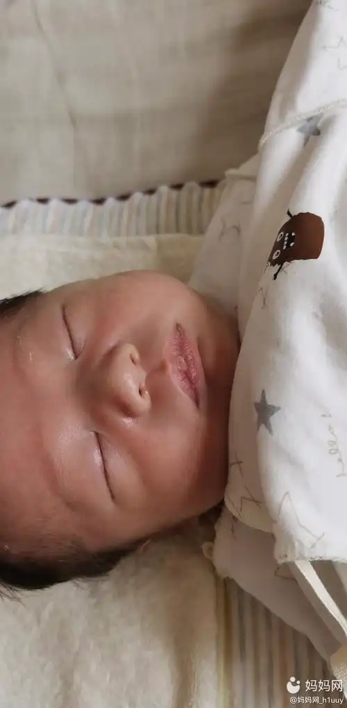 今天发现宝宝鼻子下边2彻有点发青,请问宝妈们有没有懂得,有经历过的