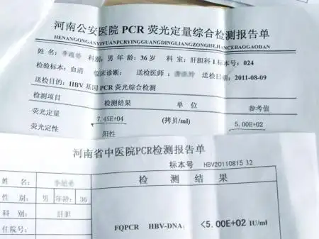 河南公an医院被曝将患者乙肝阴性查成阳性