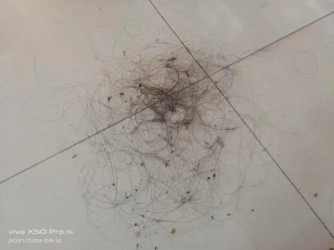 两天地上头发的量