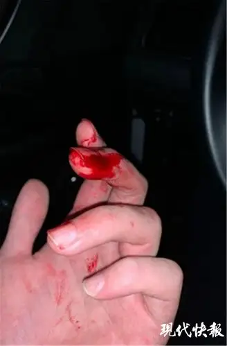 连云港小偷持刀拒捕两民警多处被划伤