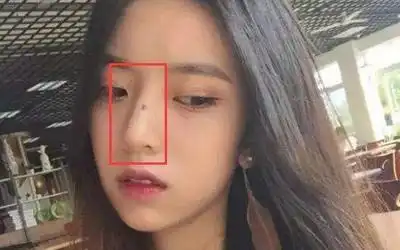 鼻梁上有痣的人会有福运吗?