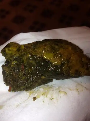 肿瘤科 腹部肿瘤 直肠癌 → 最近大便形状发生变化,粘稠,不规则!腹部