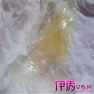 【图】精子有点黄难治吗 专家给您答案