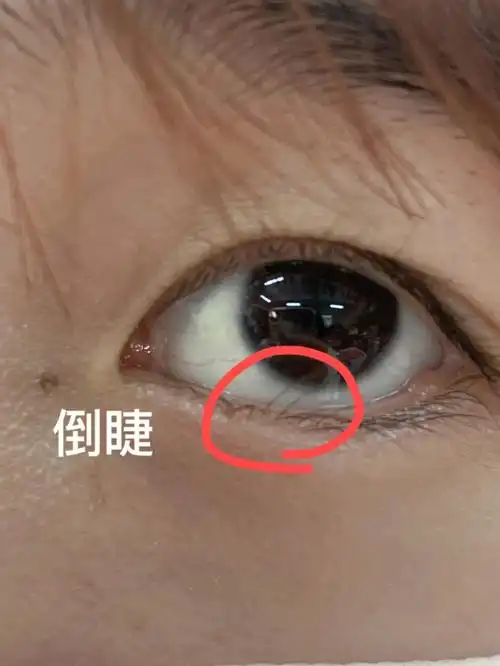 请问有什么好方法把下睫毛也弄成太阳花吗