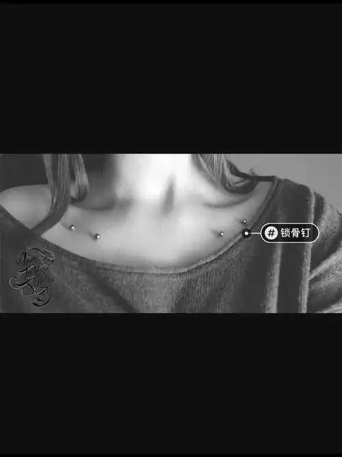 穿孔埋钉锁骨钉