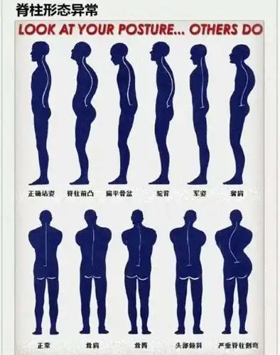 形体矫正 - 美篇
