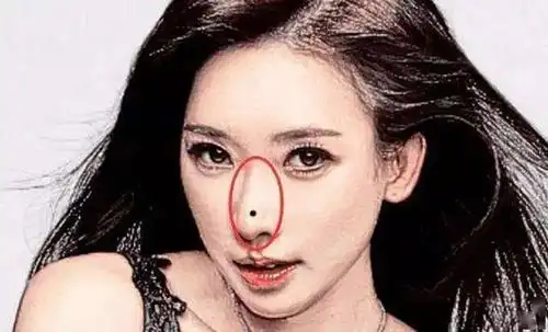 破财痣都长在哪里注定一生劳苦破财对照看看转运