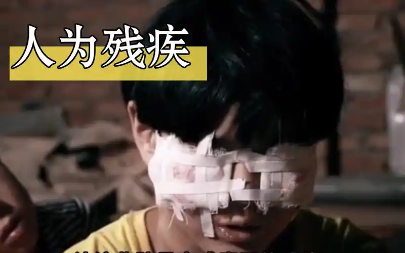 被拐儿童被打断手脚乞讨,活生生割掉器官#打拐#人贩子#儿童#真实事件