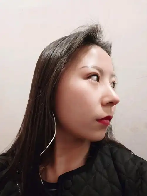 有没有和我情况一样的宝宝?你们回缩了多少