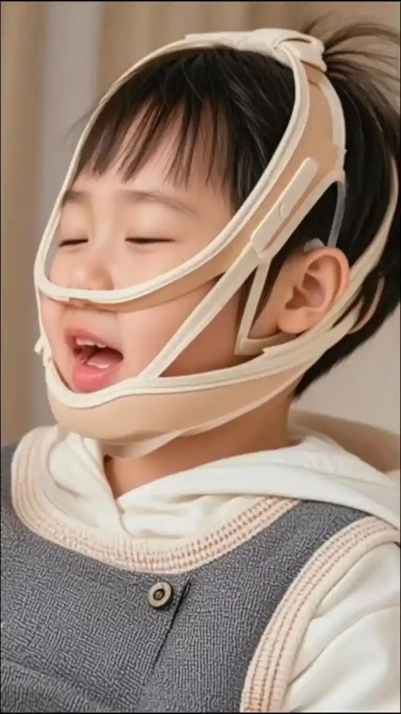 爆款热卖中 张嘴呼吸矫正器儿童闭嘴贴神器纠正改善腺样体面容